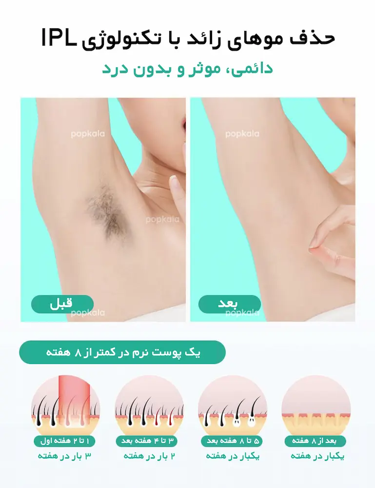 تاثیر دستگاه لیزر مو